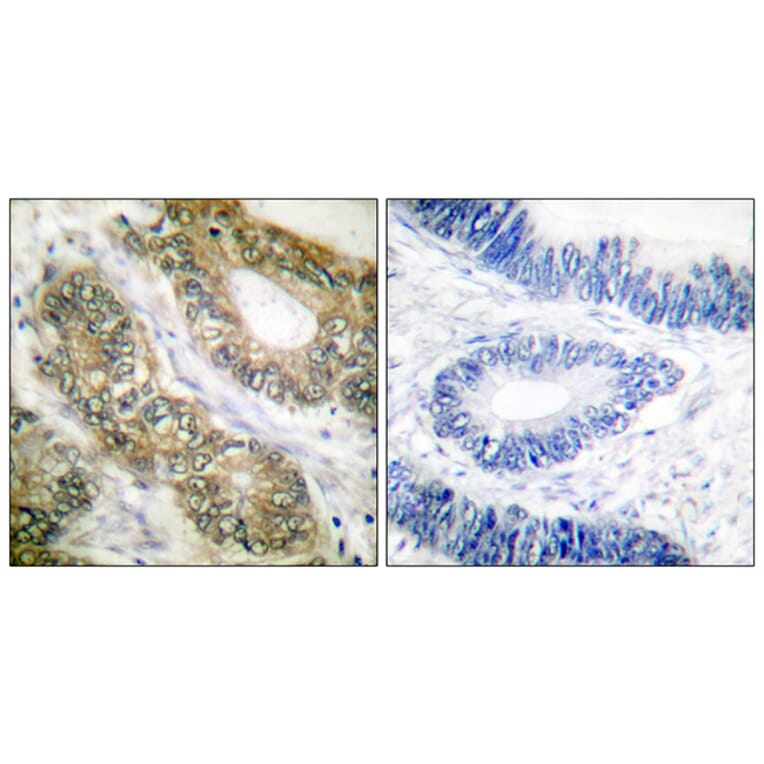 Immunohistochemistry - Anti-SEPARASE Antibody (B0086) - Antibodies.com