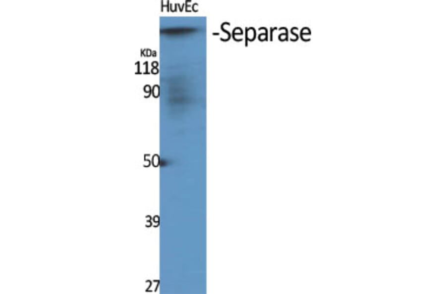 Western Blot - Anti-SEPARASE Antibody (B0086) - Antibodies.com