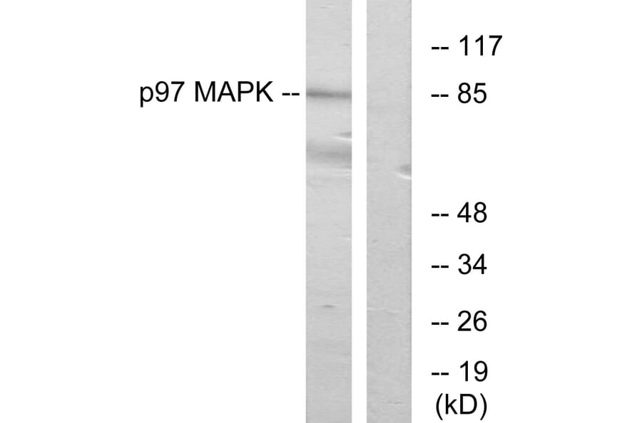Western Blot - Anti-p97 MAPK Antibody (C11136) - Antibodies.com