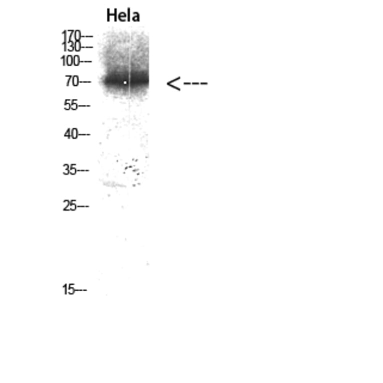 Western Blot - Anti-p97 MAPK Antibody (C11136) - Antibodies.com
