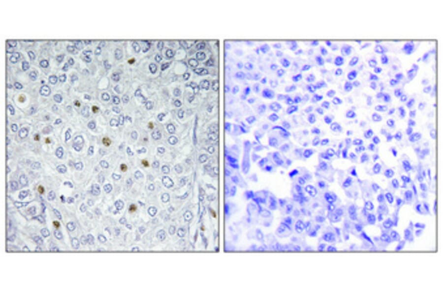 Immunohistochemistry - Anti-p97 MAPK Antibody (C11136) - Antibodies.com