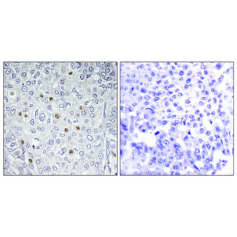 Immunohistochemistry - Anti-p97 MAPK Antibody (C11136) - Antibodies.com