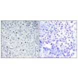 Immunohistochemistry - Anti-p97 MAPK Antibody (C11136) - Antibodies.com