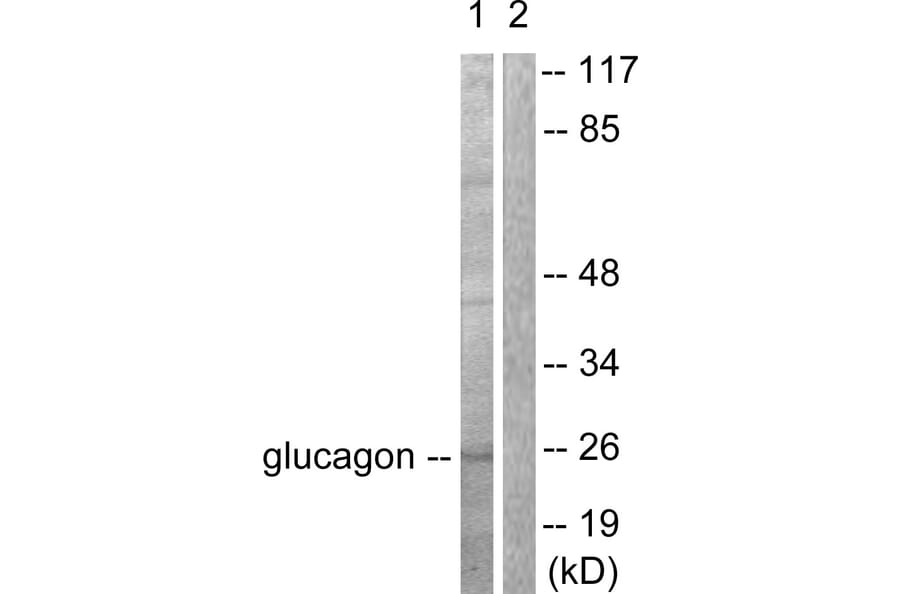 Western Blot - Anti-Glucagon Antibody (C0206) - Antibodies.com