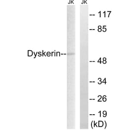 Western Blot - Anti-Dyskerin Antibody (C10152) - Antibodies.com