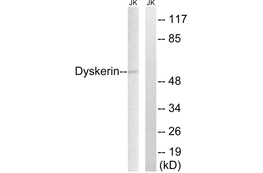 Western Blot - Anti-Dyskerin Antibody (C10152) - Antibodies.com