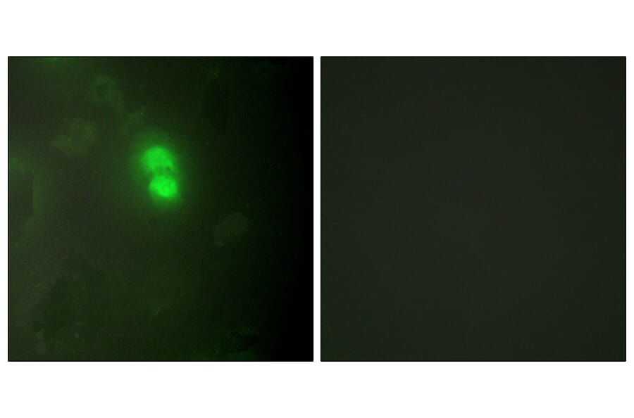 Immunofluorescence - Anti-Dyskerin Antibody (C10152) - Antibodies.com
