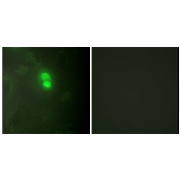Immunofluorescence - Anti-Dyskerin Antibody (C10152) - Antibodies.com