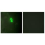 Immunofluorescence - Anti-Dyskerin Antibody (C10152) - Antibodies.com