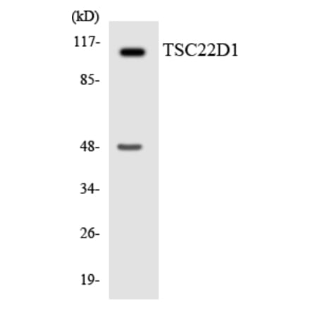 Western Blot - Anti-TSC22D1 Antibody (R12-3653) - Antibodies.com