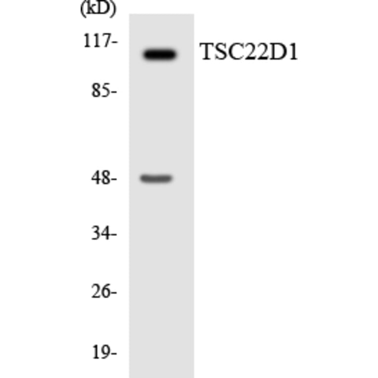 Western Blot - Anti-TSC22D1 Antibody (R12-3653) - Antibodies.com