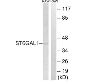 Western Blot - Anti-ST6GAL1 Antibody (C15170) - Antibodies.com