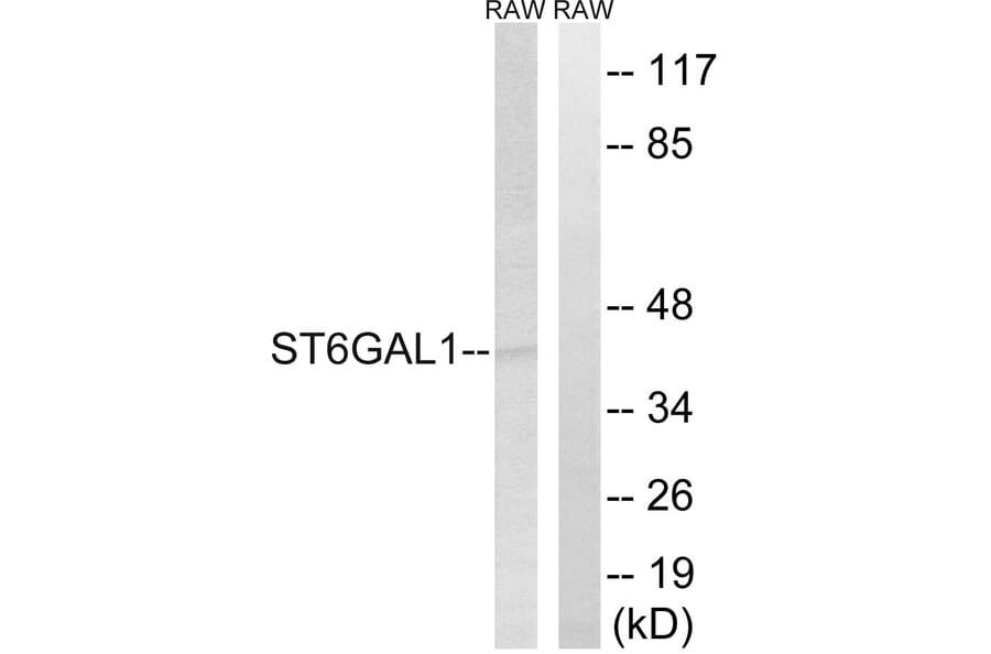 Western Blot - Anti-ST6GAL1 Antibody (C15170) - Antibodies.com