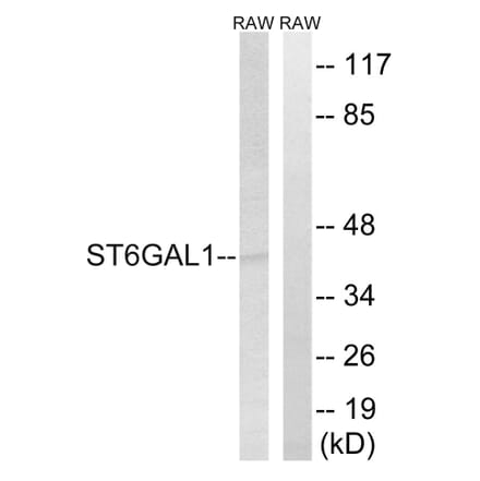 Western Blot - Anti-ST6GAL1 Antibody (C15170) - Antibodies.com