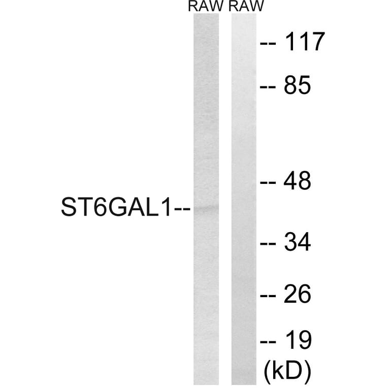 Western Blot - Anti-ST6GAL1 Antibody (C15170) - Antibodies.com