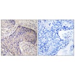 Immunohistochemistry - Anti-ST6GAL1 Antibody (C15170) - Antibodies.com