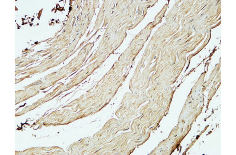 Immunohistochemistry - Anti-ST6GAL1 Antibody (C15170) - Antibodies.com