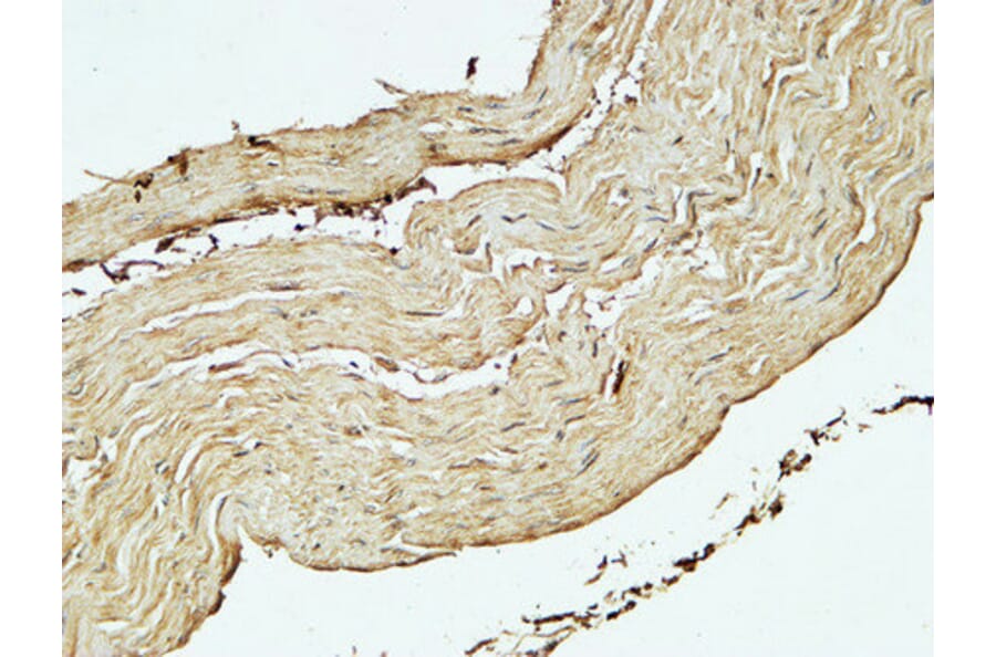 Immunohistochemistry - Anti-ST6GAL1 Antibody (C15170) - Antibodies.com