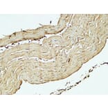 Immunohistochemistry - Anti-ST6GAL1 Antibody (C15170) - Antibodies.com