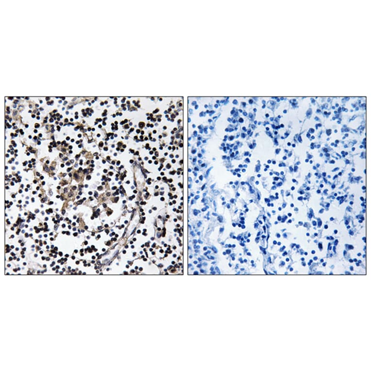 Immunohistochemistry - Anti-SLC30A4 Antibody (C19620) - Antibodies.com