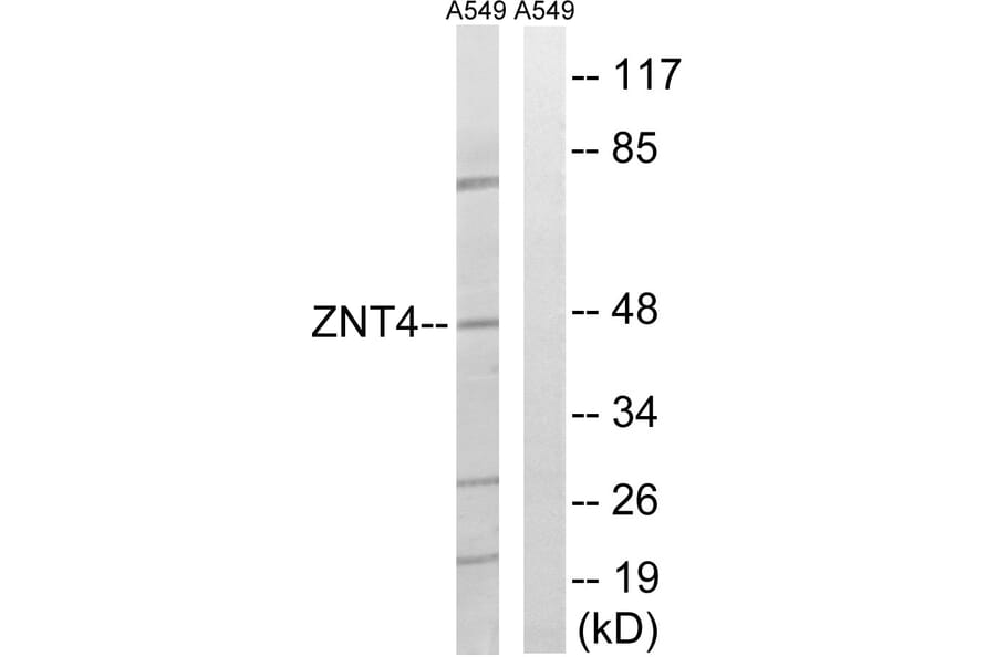Western Blot - Anti-SLC30A4 Antibody (C19620) - Antibodies.com