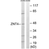Western Blot - Anti-SLC30A4 Antibody (C19620) - Antibodies.com