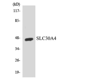 Western Blot - Anti-SLC30A4 Antibody (R12-3524) - Antibodies.com