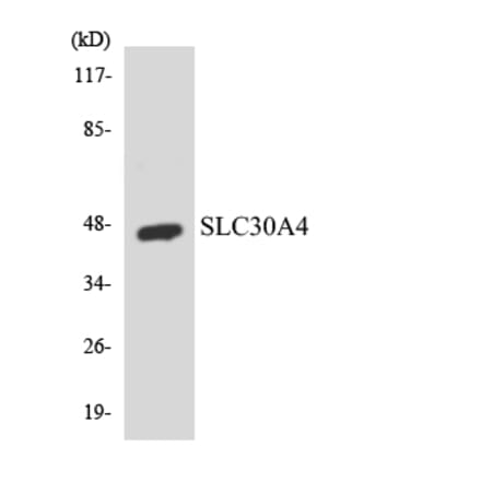 Western Blot - Anti-SLC30A4 Antibody (R12-3524) - Antibodies.com