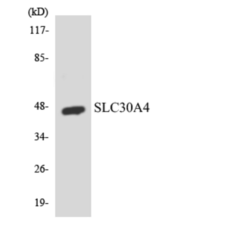 Western Blot - Anti-SLC30A4 Antibody (R12-3524) - Antibodies.com