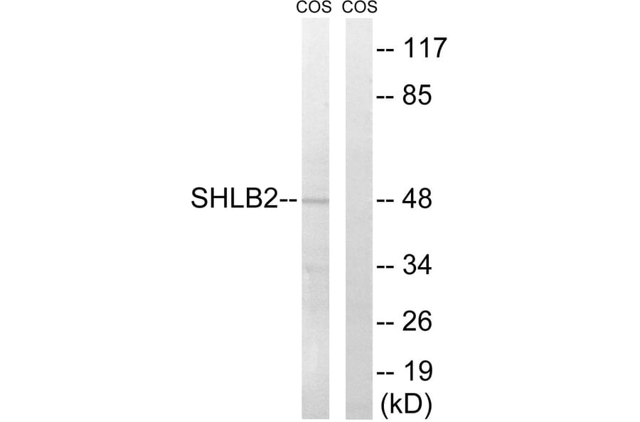 Western Blot - Anti-SH3GLB2 Antibody (C18717) - Antibodies.com