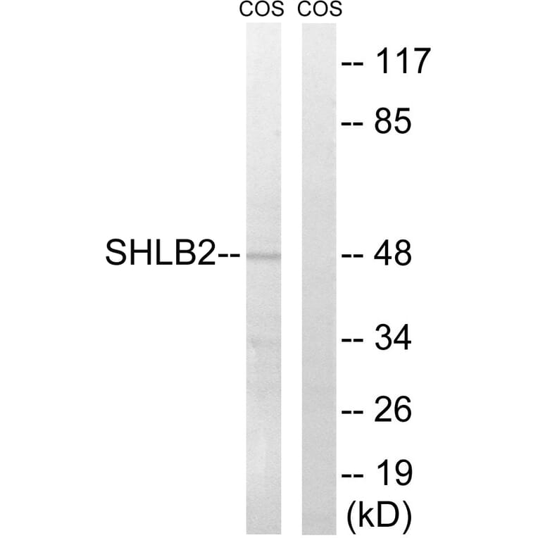 Western Blot - Anti-SH3GLB2 Antibody (C18717) - Antibodies.com