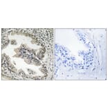 Immunohistochemistry - Anti-SH3GLB2 Antibody (C18717) - Antibodies.com