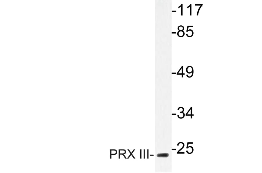 Western Blot - Anti-PRX III Antibody (R12-2323) - Antibodies.com