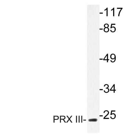 Western Blot - Anti-PRX III Antibody (R12-2323) - Antibodies.com