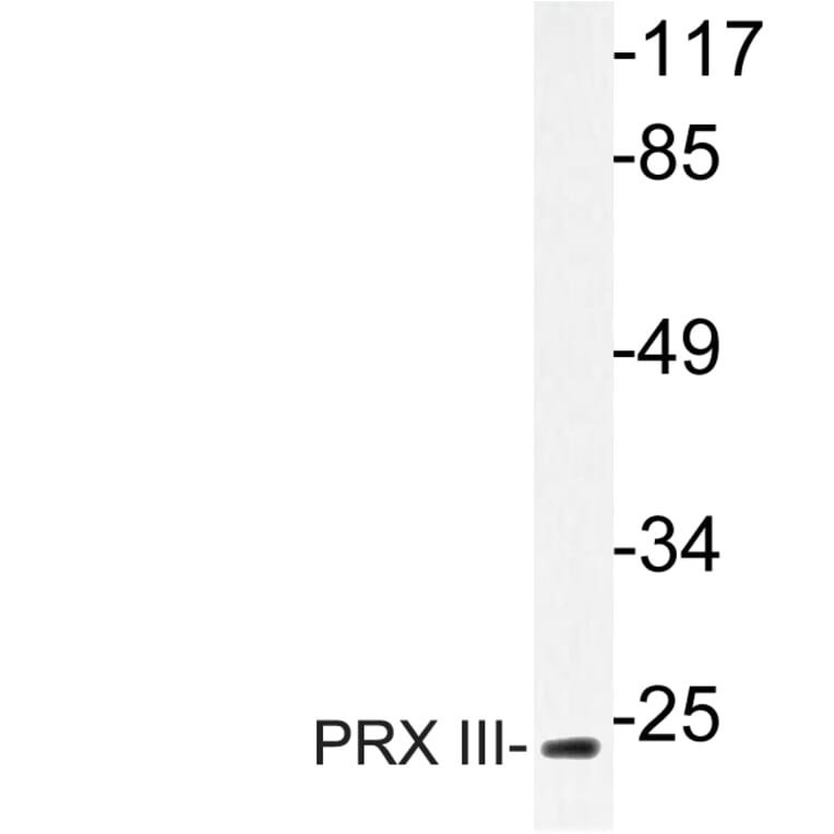 Western Blot - Anti-PRX III Antibody (R12-2323) - Antibodies.com