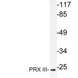 Western Blot - Anti-PRX III Antibody (R12-2323) - Antibodies.com