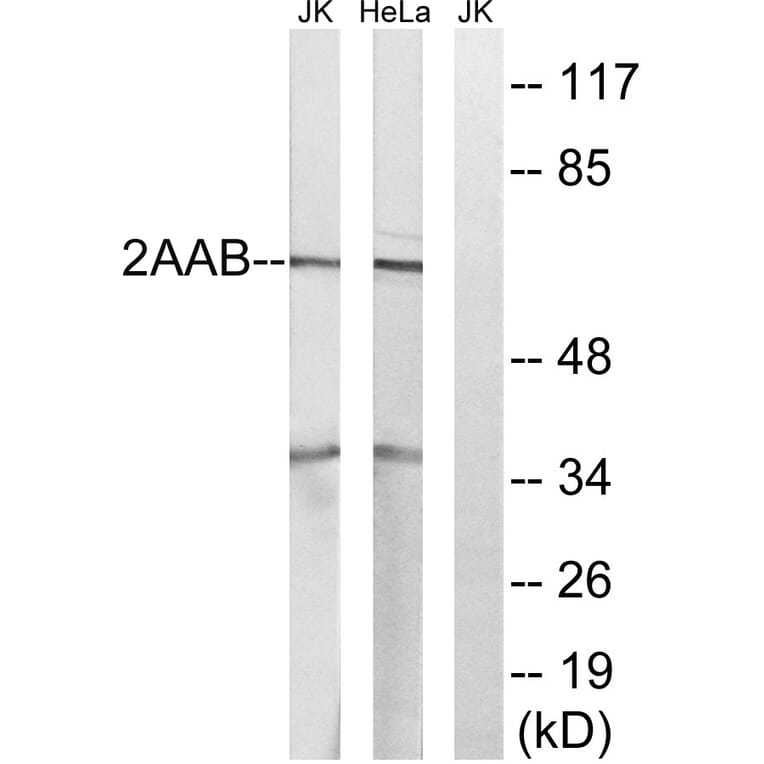 Western Blot - Anti-PPP2R1B Antibody (C18649) - Antibodies.com