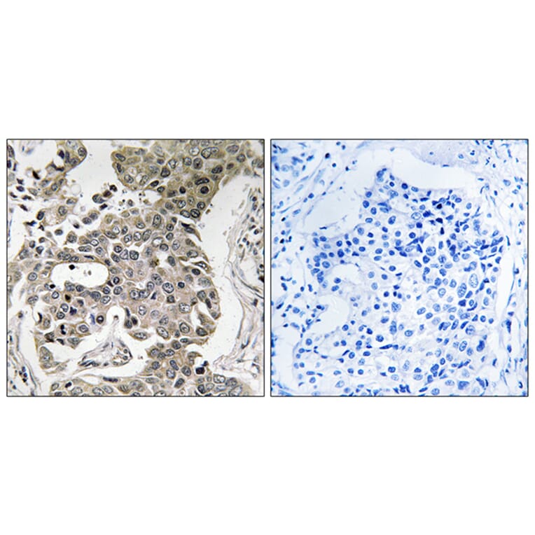 Immunohistochemistry - Anti-PPP2R1B Antibody (C18649) - Antibodies.com