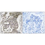Immunohistochemistry - Anti-PPP2R1B Antibody (C18649) - Antibodies.com