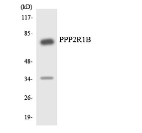 Western Blot - Anti-PPP2R1B Antibody (R12-3353) - Antibodies.com
