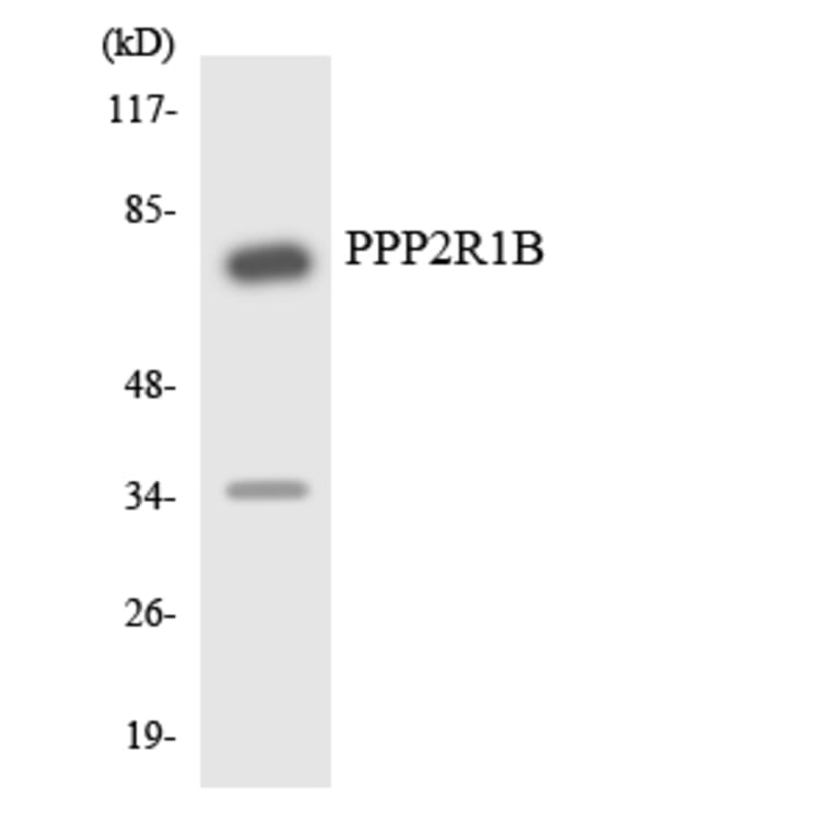 Western Blot - Anti-PPP2R1B Antibody (R12-3353) - Antibodies.com