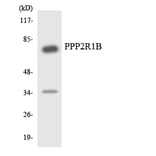 Western Blot - Anti-PPP2R1B Antibody (R12-3353) - Antibodies.com