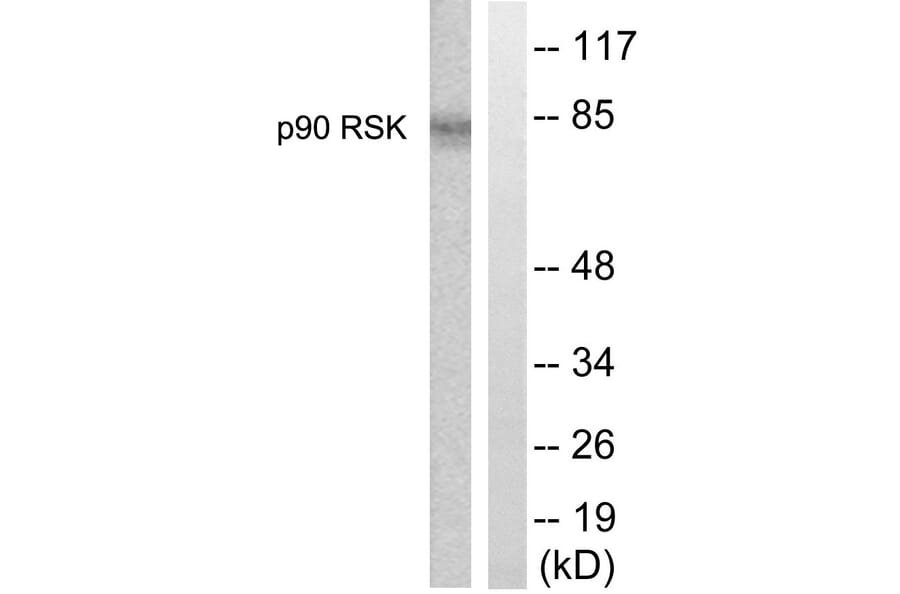 Western Blot - Anti-p90 RSK Antibody (B0535) - Antibodies.com
