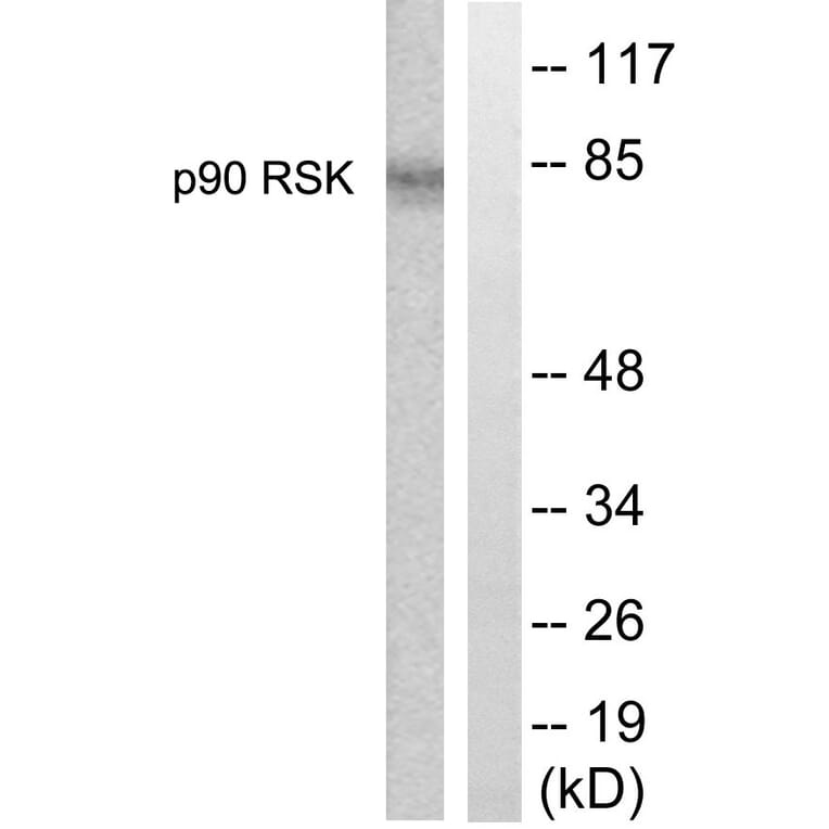 Western Blot - Anti-p90 RSK Antibody (B0535) - Antibodies.com