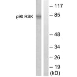 Western Blot - Anti-p90 RSK Antibody (B0535) - Antibodies.com