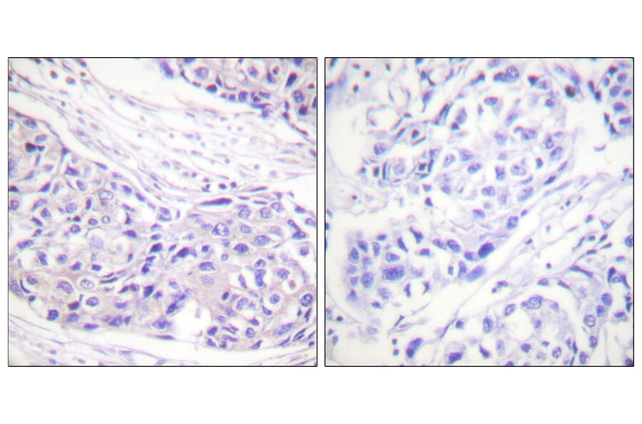 Immunohistochemistry - Anti-p90 RSK Antibody (B0535) - Antibodies.com
