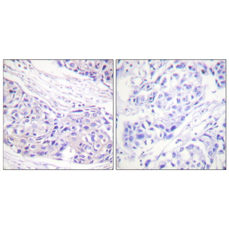 Immunohistochemistry - Anti-p90 RSK Antibody (B0535) - Antibodies.com