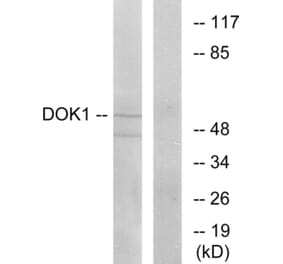 Western Blot - Anti-p62 Dok Antibody (B7057) - Antibodies.com
