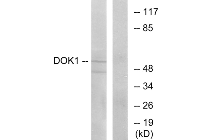 Western Blot - Anti-p62 Dok Antibody (B7057) - Antibodies.com