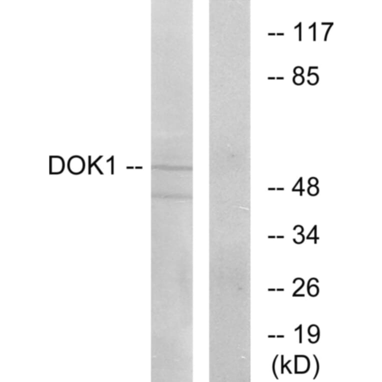 Western Blot - Anti-p62 Dok Antibody (B7057) - Antibodies.com